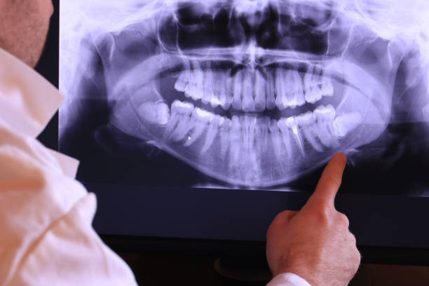 Best Emergency Gum Treatment in Dawsonville, GA