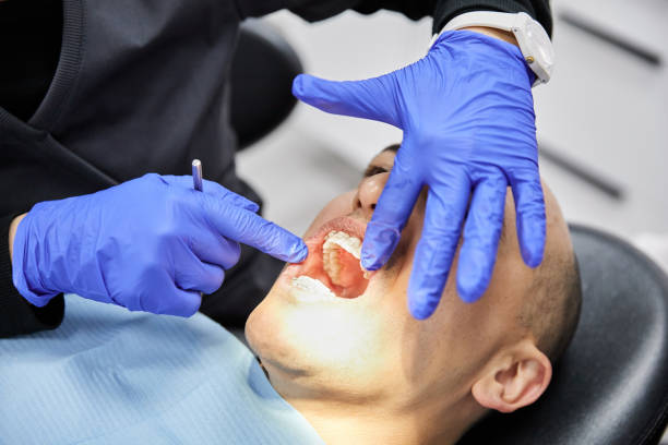 Best Emergency Dental Care for Broken or Chipped Teeth in Dawsonville, GA